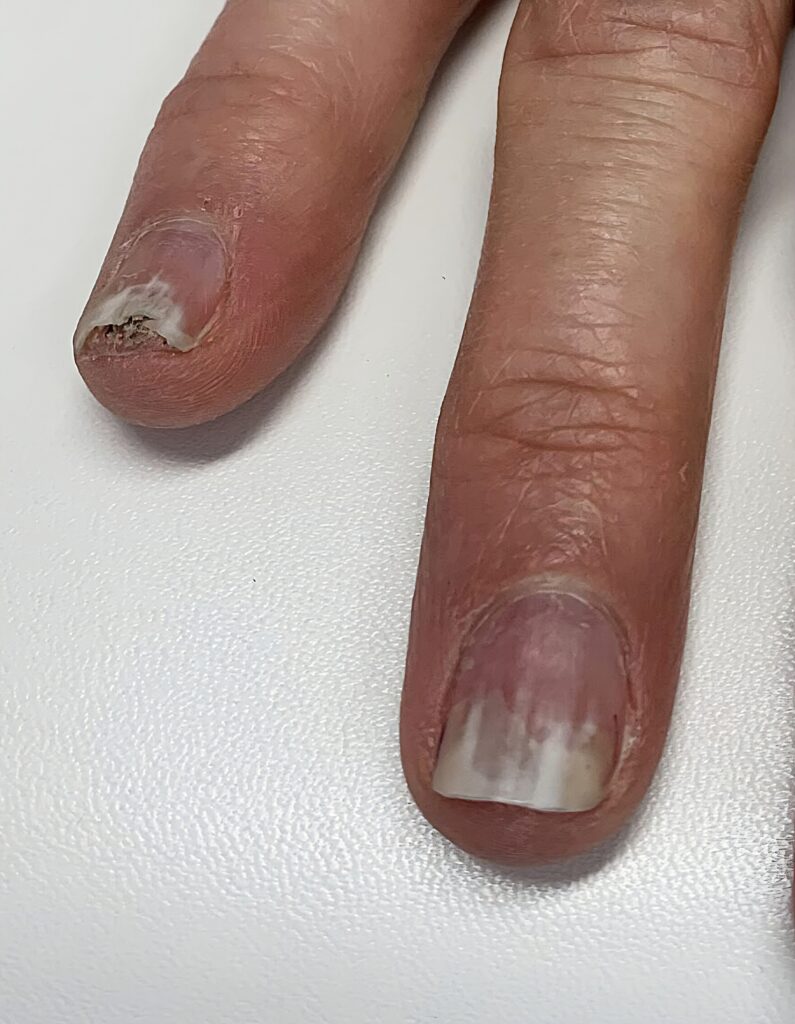 bebeauty-kristiansand-Neglesopp